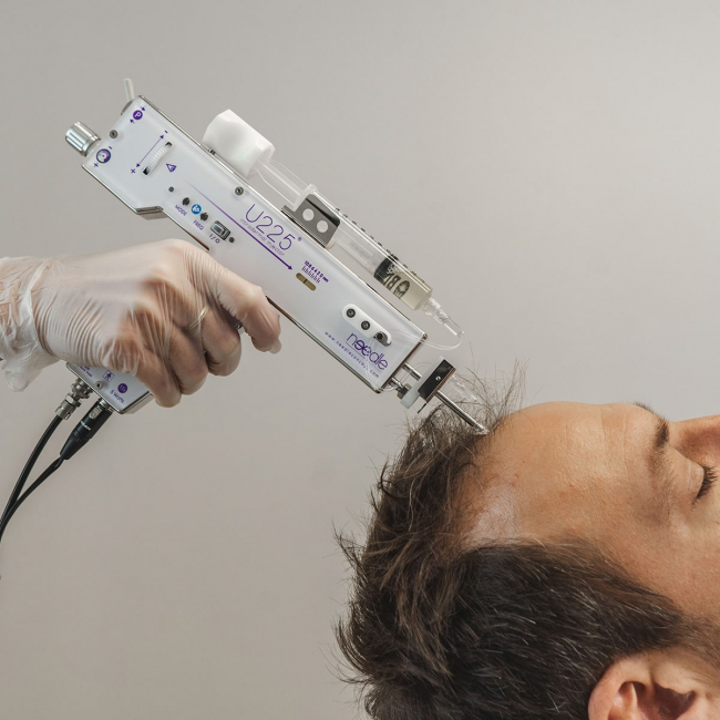 PRP cheveux: stimuler la pousse capillaire