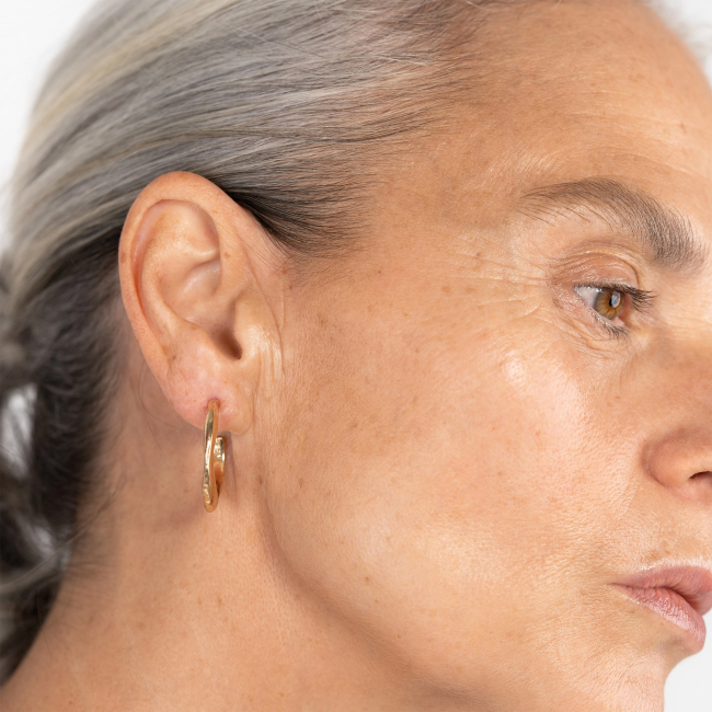 Technologie Ultherapy Prime® à Angers : lifter sans chirurgie