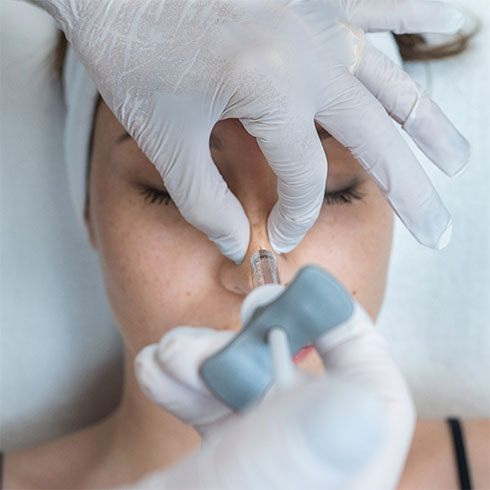 La rhinoplastie médicale